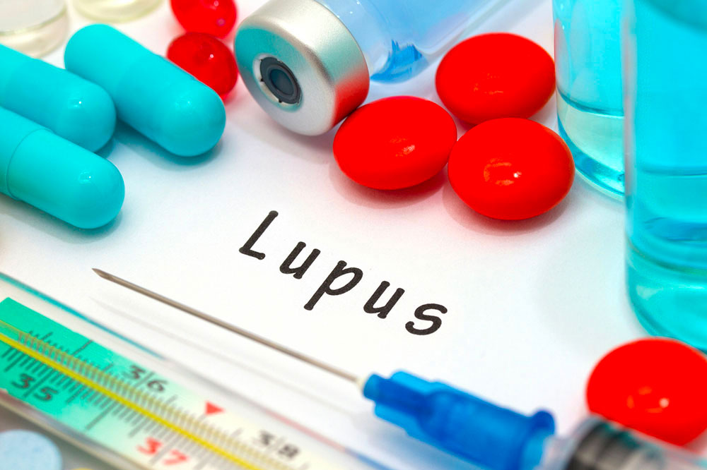 9 early signs and symptoms of lupus