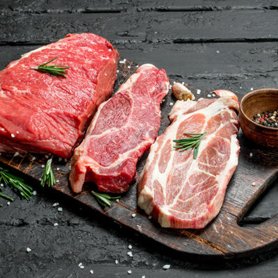 Prurigo nodularis – Foods to avoid, and management options