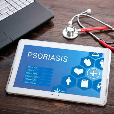 Easy DIY remedies to treat psoriasis symptoms