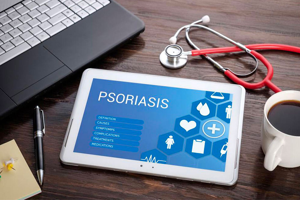 Easy DIY remedies to treat psoriasis symptoms